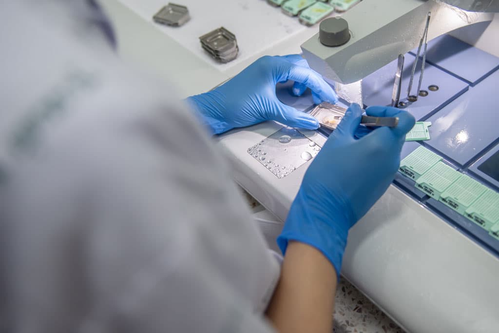 Hacer biopsia en Ponferrada